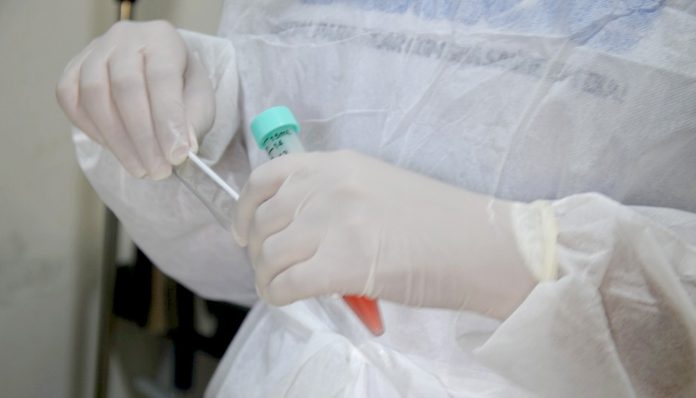 foto-1-testagens-estao-incluidas-no-plano-de-contingencia-contra-a-covid-19jpg
