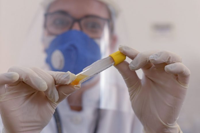 teste-covid-19-laboratorio-municipal-de-palmas-to-foto-raiza-milhomem-1-1-scaled