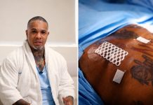 Rodriguinho passa por cirurgia reparadora para retirar excesso de pele após emagrecimento
